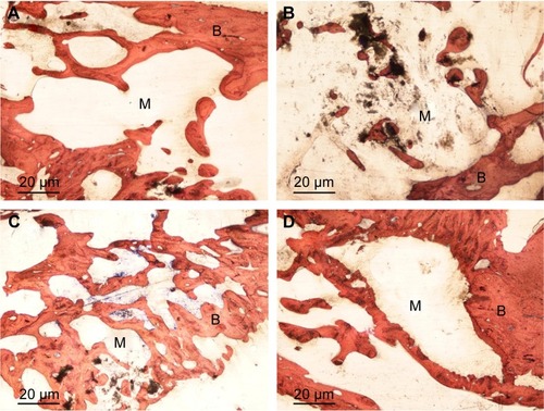 Figure 9 Histological evaluation (H&E staining) depicting material degradation and new bone formation after in vivo implantation of n-BPC (A, C) and PCL–PEG–PCL (B, D) scaffolds for 6 and 12 weeks, respectively.Abbreviations: B, new bone; H&E, hematoxylin–eosin; M, materials; n-BPC, n-BD/PCL–PEG–PCL composite; n-BD, nanobredigite; PCL–PEG–PCL, poly(ε-caprolactone)–poly(ethyleneglycol)–poly(ε-caprolactone).
