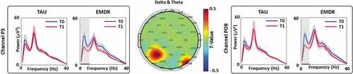 Figure 1. T0 vs. T1 power spectral density analysis (PSD).