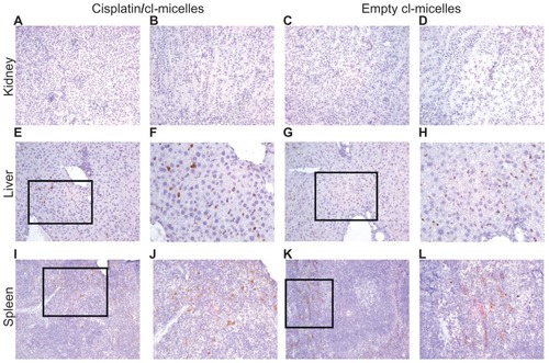 Figure 7 Immunohistochemistry images of PEG stained tissues from acute toxicity analysis in female C57Bl/6 mice.Notes: No accumulation was observed in the kidney (magnification 200×) from either cisplatin-loaded (A, cortex; B, tubules) or empty micelles (C, cortex; D, tubules) treatment groups. Liver (E–F, cisplatin/cl-micelles; G–H, empty micelle) and spleen (I–J, cisplatin/cl-micelles; K–L, empty micelle) showed strong accumulation of micelles (magnification 200×/400×). Spleen shows accumulation of micelles only in the red pulp region.