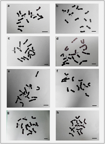 Figure 5. Hand drawings of different cultivars of Lens culinaris showing intercalary sat chromosome. (a) EC-78410; (b) EC-78451-A; (c) EC-78452; (d) EC-78475; (e) EC-78476; (f) EC-78542-A; (g) EC-223188; (h) EC-255491. Arrows indicate chromosomes with secondary constrictions. Bar = 5 μm.