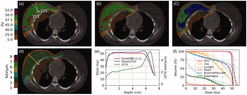 Figure 1. The color-washed isodose distribution of a representative breast patient planned with (a) RayStation Dose(RBE = 1.1), (b) MCsquare Dose(RBE = 1.1), and (c) LETd-weighted dose. The beam angles of 355 and 325 degrees for this plan are indicated in panel (a). The color-washed LETd is displayed in panel (d). The red contour is the target volume. The dose profiles of the MCsquare Dose(REB = 1.1), the LETd-weighted dose, and the LETd are displayed in panel (e) and the profile line is indicated in panel (d). The DVH is shown in panel (f).