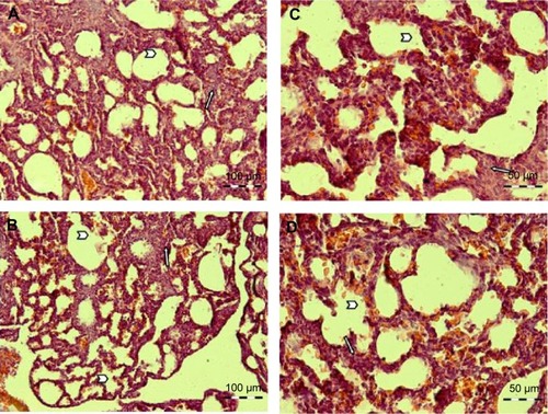 Figure 6 A representative picture of hematoxylin and eosin staining of rat lungs.