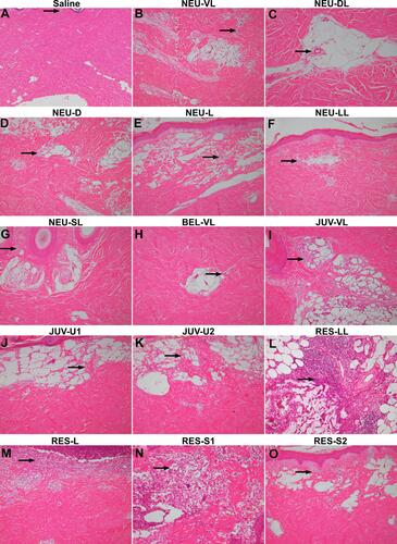 Figure 2 Hematoxylin and eosin staining at 1 and 4 weeks after intradermal injection of the saline control (A), NEU series (B–G), BEL-VL (H), JUV series (I–K), and RES series (L–O). Arrows indicate the location of the inflammatory cells. All images are shown at the same magnification (× 40).