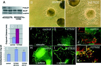 Figure 2 ROCK inhibition decreases PE outgrowth. A, PE monolayers treated with the ROCK inhibitor Y-27632 have decreased levels of phosphorylated myosin light chain phosphatase (A). Phase contrast images of PE outgrowth after 24 hr untreated (B) of treated with Y-27632 (C). Outgrowth distance is approximately 2-fold higher with Y-27632 treatment (D). The number of lamellipodia per outer ring PE outgrowth cell is increased somewhat by Y-27632 treatment, particularly at 24 hr (E). Vinculin and α -actinin localization in untreated and treated outgrowth cultures suggests a transition from focal adhesions to focal complexes (F-I). Y-27632 treatment disrupts actin stress fibers (J, K).