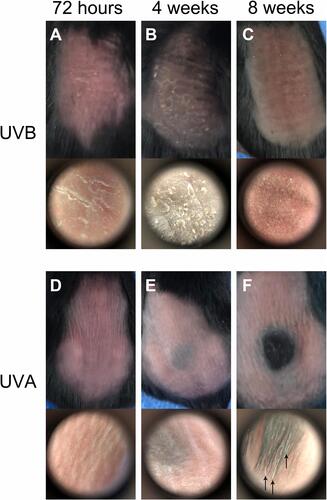 Figure 1 Skin damage by UV irradiation. (A–C) At 72 hr after 1 minimal erythemal dose (MED) irradiation of UVB, epidermal exfoliation could be found on the dorsum of C57BL6/J mice and clearly shown by dermoscopy (60x). During anagen, the dorsum of mice was black and the exfoliation of epidermis was more serious in the UVB group in the 4th week. There were heavy wrinkles on the dorsum of mice, and the photoaging skin was tanned and coarse by the 8th week. (D–F) Erythema was the striking feature of skin on the dorsum of mice in the UVA group. After 4 weeks’ irradiation, pigmentation formed on the back of mice. In addition, there were more grey hairs in the experimental region of the UVA group in the 8th week (P<0.01).