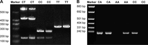 Figure 1 Enzyme digestion results of rs5745652 and rs2074725 sites of the HGF gene.