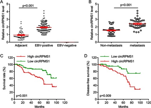 Figure 1 CircRPMS1 is upregulated in NPC.Notes: (A) The expression of circRPMS1 in EBV-positive and -negative NPC tissues and adjacent tissues. (B) The expression of circRPMS1 in patients with metastatic NPC or without metastasis. (C) Kaplan–Meier curves of overall survival in NPC patients with low or high circRPMS1 expression. (D), Kaplan–Meier curves of disease-free survival in NPC patients with low or high circRPMS1expression.Abbreviations: EBV, Epstein-Barr virus; NPC, nasopharyngeal carcinoma.