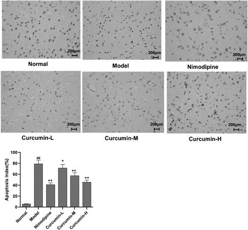 Figure 3. Effect of curcumin on neuronal apoptosis in hippocampal CA1 region of rats. TUNEL was used to assess apoptosis. Representative TUNEL staining images were shown. Apoptosis index was calculated as number of apoptotic cells/(total number of cells)×100%. Compared with the normal, ##p < 0.01; compared with the model, *p < 0.05, **p < 0.01. Scale bar: 200 μm.