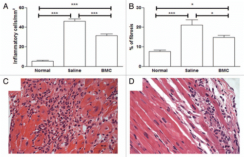 Figure 1 Transplantation of BMC decreases inflammation and fibrosis in hearts of C57Bl/6 mice chronically infected with Colombian strain T. cruzi. Mice were infected with 1,000 trypomastigote forms of Colombian strain T. cruzi. Inflammation (A) and fibrosis (B) were quantified in heart sections of normal mice, mice 8 months after infection injected with saline (Saline) or with bone marrow cells (BMC), stained with H&E and Sirius red. Bars represent the means ± SEM of 5–8 animals/group at six months after infection. *p < 0.05; ***p < 0.001. Heart sections of chagasic mice injected with saline (C) or with BMC (D), stained with H&E (original magnification ×40).