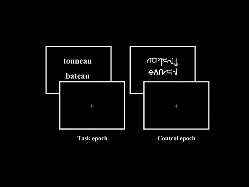 Figure 1 Examples of stimuli presented during fMRI paradigm, respectively “Task” (pairs of readable words) and “Control” (pairs of unreadable words written in Karalyn Patterson font) conditions. Concerning the “Task”, patients and controls were instructed to judge whether the words rhymed (rhyme detection task, “task epoch”). Concerning the “Control”, patients and healthy controls were instructed to judge whether the words contained at least one character which overshot the others.