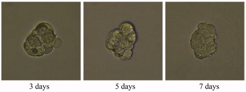 Figure 36. Gold nanoparticle (AuNP) and folic acid treatment group for 3D tumour spheroid. Scale bar = 100 μm.