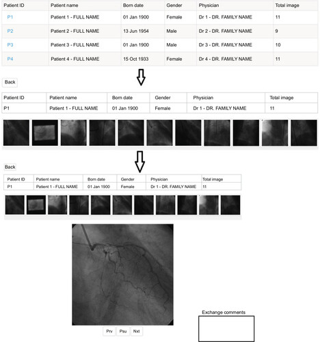 Figure 4 Web-based angiography viewer WebXA.