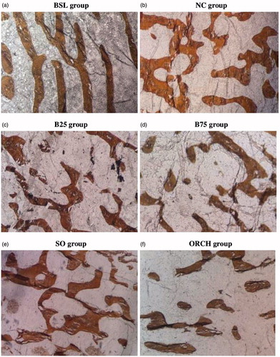 Figure 2. Photomicrograph of trabecular bone at distal femur. Undecalcified section (×100 magnification) shows trabecular bone with white background stain using the von Kossa method in the five study groups. Note that the buserelin groups (25 µg/kg and 75 µg/kg) and orchidectomy groups showed lower bone volume and higher in trabecular separation compared with their respective control groups. BSL: baseline group; NC: normal group; B25: buserelin 25 µg/kg group; B75: buserelin 75 µg/kg group; SO: sham group; ORCH: orchidectomy group.