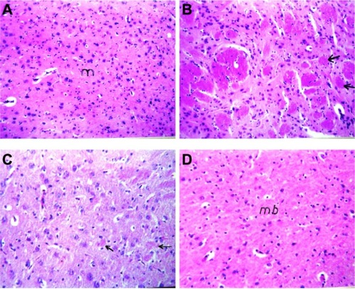 Figure 6 Photomicrographs of brain section of (A) control rats and (B) aluminium chloride (AlCl3)-treated rats. Arrows refer to focal area of deep eosinophilic round of amyloid plaque. (C) AlCl3-intoxicated rats treated with rivastigmine solution. Arrows refer to few small plaques in the mid brain with diffuse gliosis. (D) AlCl3-intoxicated rats treated with rivastigmine liposome formulation (hematoxylin and eosin 40x).