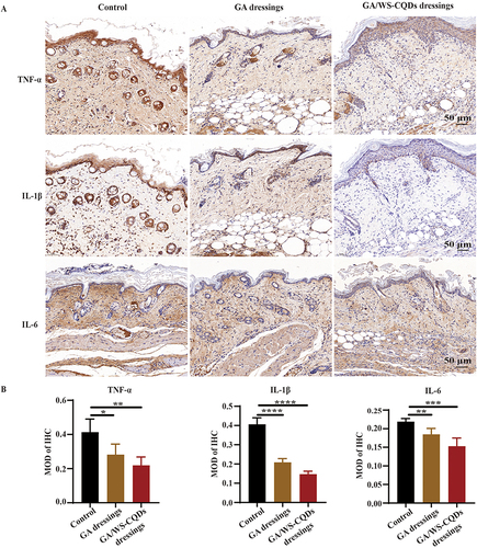 Figure 7 GA/WS-CQDs dressing inhibited wound inflammation in vivo. (A) Immunohistochemical staining images of proinflammatory factors including TNF-α, IL-1β and IL-6 in MRSA-infected wound skin tissues. Scale bar, 50 μm. (B) Quantification of the mean intensities for the areas positive from (A). ****p < 0.001, ***p < 0.005, **p < 0.01, and *p < 0.05.