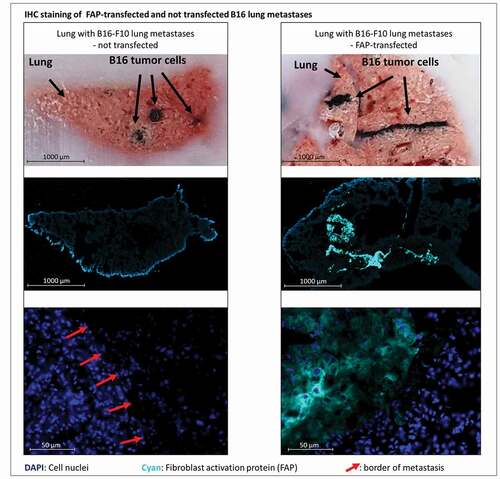 Figure 3. Bright field and immunofluorescent staining of lungs containing metastases derived from either murine FAP-transfected (right) or non-transfected (left) B16 melanoma cells at day 21 after injection of tumor cells. Pigmented B16 cells can be recognized in the bright field (top row). Murine FAP in cyan blue, cell nuclei in blue (DAPI). In the top row cut ends of cryo-section tissue blocks are depicted so that metastases can be localized in the corresponding stained cryo-sections below (middle row). The close-up images (bottom row) show normal lung tissue and parts of metastases. Red arrows indicate borders of metastases