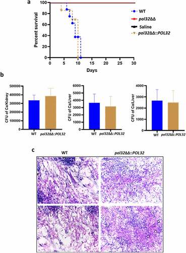 Figure 9. Mice model of systemic candidiasis. a. Male BALB/c mice of 6–7 weeks of age were inoculated either with WT or pol32ΔΔ or pol32ΔΔ::POL32 (5x106 CFU) C. albicans strains intravenously along with saline control and monitored their survival for 30 days. The survival curve was plotted using Graph pad prism 8.0 software. b. The murine kidney, liver, and spleen were collected and fungal burden was measured in all these organs by CFU determination. c. The kidneys of WT and pol32ΔΔ::POL32 mice (n = 2) were stained with PAS staining and images were captured in a light microscope with 40X magnification.