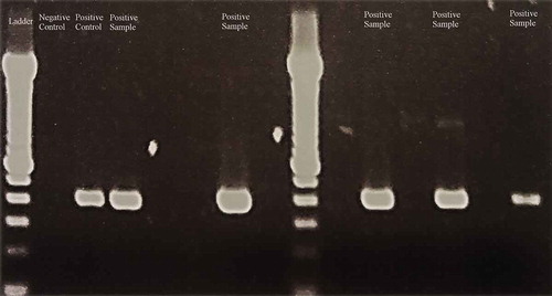 Figure 3. Images of agarose gel showing the migration of amplicons from an amplification by nested PCR (conventional PCR as the first step and real-time PCR as the second step) using primers designed for Porphromonas gingivalis. (Lane 1 and 9:) Ladder. (Lane 2:) Negative control. (Lane 3:) Positive control. (Lanes 4–8 and 10–15:) Samples. Samples from (lanes 4, 7, 11, 13, and 15) had an amplicon with the same molecular weight as the positive control. They were confirmed to be positive by comparison of the melting curves and by sequencing