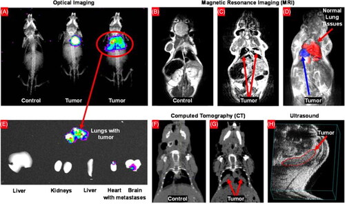 Figure 4. Imaging evaluation of the orthotopic lung cancer model. (A) Bioluminescence optical imaging of control mouse and lung tumor mice of various sizes. (B–D) Magnetic resonance imaging of the control mouse (B) and lung tumor mice of various sizes (C, D). Healthy lung tissues (red) and lung tumors (blue) are displayed (D). (E) Optical imaging of excised organs. (F, G) Computed tomography images of a control mouse (F) and mouse with lung tumors (G). (H) Visualization of lung tumor by the ultrasound imaging system. Reproduced with permission from (Taratula et al., Citation2013).