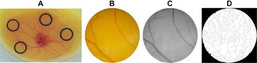 Figure 2 CAM assay.Notes: (A) Position of the silicon O-rings in the developing blood vessels plexus of the yolk sac membrane. (B) RGB image of the O-ring interior used for counting the number of veins. (C) Green channel of the same image. (D) Binary of the segmented image used to calculate the number of branches.Abbreviations: CAM, chorioallantoic membrane; RGB, red, green, and blue.