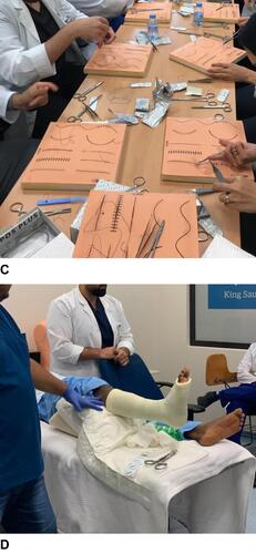 Figure 1b Workshop hands-on training on minor office procedures; (A) neonatal circumcision model; (B) incision and drainage of superficial abscess; (C) suture and laceration repair; (D) applying below knee cast to simulated patient.