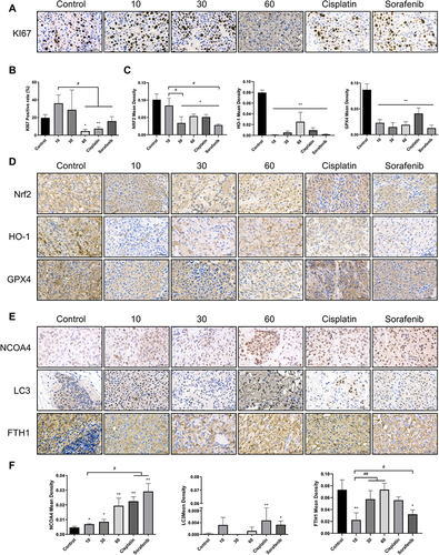 Figure 8 Esculetin’s effects on hepatocellular cancer proteins expression in vivo. Using immunohistochemistry, (A and B) KI67 expression, (C and D) antioxidant protein NFE2L2, GPX4 and HO-1 expression, (E and F) ferritinophagy-proteins NCOA4, FTH1 and LC3 expression were measured. The ruler measures 50μm. The results were displayed as mean ± SD (n=3). Compared with the Control group, *p<0.05, **p<0.01. Compared with the 10mg/kg group, #p<0.05, ##p<0.01.