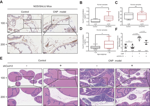Figure 5 Functional role of CXCL12 in chronic prostatitis. (A) Immunohistochemistry (IHC) analyses of the CXCL12 expression between prostate tissues derived from chronic nonbacteria prostatitis (CNP) and negative controls. (B–D) ELISA suggested the expression differences between CP/CPPS and healthy control (B & C), and age subgroups (D). (E) Hematoxylin and eosin (HE) staining showed the infiltration status of inflammatory cells in different virus treatment subgroups (four mice in each group). (F) Quantification analysis showed the inflammatory score variations between groups.