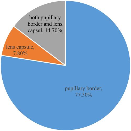 Figure 1 A pie chart showing the location of pseudoexfoliation among study participants at Gondar University comprehensive specialized Hospital Tertiary Eye Care and Training Center, Ethiopia 2019.