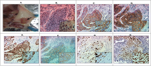 Figure 6. 76N.TERT cells co-overexpressing Ecd and Ras form tumors upon mammary fat pad implantation in NOD/SCID mice. (A) Tumors were resected. Representative tumor in the mammary gland indicated by an arrow. (B) H & E staining of tumors formed by Ecd+Ras overexpressing cells resected at euthanasia. (C–H) Immunohistochemical analysis of tumor sections for Ecd (C), Ras (D), Vimentin (E), E-cadherin (F), Ki-67 (G), and p63 (H). Pictures were taken at 20X magnification (insets at 40×).