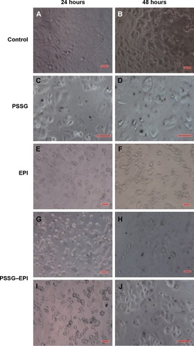 Figure 5 Real time morphology observations of MCF-7 cells.Notes: Control group (A and B). After MCF-7 cells were exposed to PSSG (5 μg/mL) for 24 hours (C) and 48 hours (D), the cellular outlines still remained, and the density of cells were quite high compared with the control group (A and B), indicating that the nanocarrier itself almost has no effect on the growth of living cells in vitro, which makes it possible to be a promising low toxic drug carrier system. On the contrary, after 24 or 48 hours incubation with pure EPI (2 μg/mL in (E) and (F)) or PSSG–EPI (with corresponding concentration of EPI at 2 μg/mL in (G) and (H), 10 μg/mL in (I) and (J)), cells grew slowly with a low density. Scale bar, 40 μm.Abbreviations: EPI, epirubicin; PSSG, PSS-decorated nanographene; PSS, poly(sodium 4-styrenesulfonate).