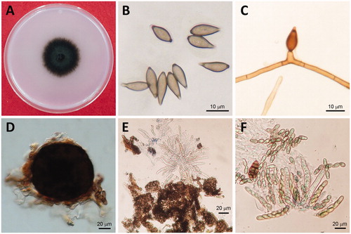 Figure 2. Mycological characteristics of Venturia nashicola. (A) 60 d-old colony on PDA at 20 °C in the dark; (B) Conidia; (C) Conidiophore; (D) Pseudothecia, (E) Asci; (F) Ascospores.