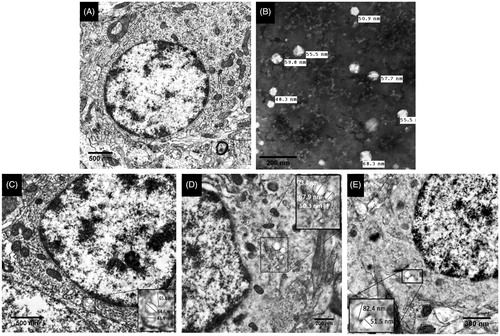 Figure 5. Electron micrographs of (A) a neuronal cell from the orbitofrontal cortex of a rat in the control group on the 13th day of the study showing normal nuclear structure and intact organelles; (B) CX-NP2 in vitro with a diameter of 48.3 to 68.3 nm; (C)→(E) neuronal cells from the orbitofrontal cortex of a rat in the nasal CX-NP2 treated group on the 13th day of treatment period showing CX-NP2 with a diameter of 43.9 to 82.4 nm within lysosomes (indicated and magnified by the square boxes).
