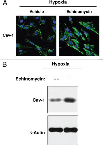 Figure 7 Pharmacological inhibition of HIF-1α rescues the hypoxia-induced downregulation of Cav-1. (A) Immunofluorescence. hTERT-fibroblasts were subjected to hypoxia (0.5% O2) for 24 hours in the presence of the HIF-1α inhibitor echinomycin (10 ng/ml) or vehicle alone (DMSO). Then, the cells were fixed and stained with anti-Cav-1 (green) antibodies and DAPI nuclear stain (blue). Note that treatment with the HIF-1α inhibitor rescues the hypoxia-induced downregulation of Cav-1, as compared to vehicle alone treated cells. Original magnification, 60x. (B) Western blot. hTERT-fibroblasts were subjected to hypoxia (0.5% O2) for 48 hours in the presence of echinomycin (2 ng/ml) or vehicle alone (DMSO). Cell lysates were analyzed by western blot analysis using anti-Cav-1 antibodies. Note that Cav-1 levels are greatly increased upon treatment with the HIF-1α inhibitor. β-actin was used as an equal loading control.