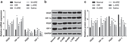 Figure 6. VEGF and HIF-1α were inhibited, while PEDF and IGF-1 were promoted by Astragalus root extract in retinal tissues of the OIR model mice (a) The expression of VEGF, HIF-1α, PEDF, and IGF-1 mRNA in the retina of newborn mice in each group detected by RT-qPCR; (b) The protein bands of VEGF, HIF-1α, PEDF, and IGF-1 in the retina of newborn mice; (c) Statistical analysis of protein expression in Figure b. The data are all measurement data, in the form of mean ± standard deviation, and the comparison among groups was analyzed by one-way ANOVA. The LSD-t-test was used for pairwise comparison after ANOVA analysis; * P< 0.05 vs. the normal group; # P < 0.05 vs. the OIR group, N = 10