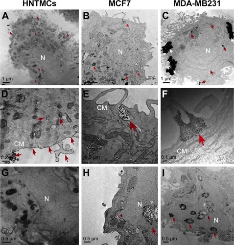 Figure 1 Electron micrography of cells exposed to maghemite–rhodium citrate nanoparticles (MRC NPs) for 6 hours.Notes: Human nontumor mesenchymal cells (HNTMC) in first column showing some MRC NPs (indicated by red arrows) inside the cytoplasm (A, D), and a substantial amount of NPs surrounding the cell membrane (CM) surface (D). Images of MCF7 (second column) and MDA-MB231 (third column) cells revealed MRC NPs, often present within cytoplasm (B, C). MRC NPs within vesicles in MCF-7 cells (E). Bigger clusters of MRC NPs (white arrows) were found in MDA-MB231 cells (C, F). MRC NPs reached the nucleus (N) in MCF7 and MDA-MB231 cells (H, I) while free NPs in the nucleus were observed in HNTMCs (G). Red arrowhead shows perinuclear vacuoles in MCF7 cells (H). *Karyorrhexis evidenced in MCF7 (H) and MDA-MB231 (I) nuclei.