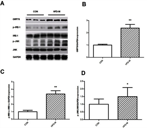 Figure 2 Effects of HFD-M on the expression of ER stress-related proteins in subcutaneous fat tissue of rats. (A) Representative GRP78, p-IRE1-α, p-JNK Western blots; Quantification of the Western blot membranes for (B) GRP78; (C) p-IRE1-α; (D) p-JNK. Data were presented as mean ± SD, n=6 each group; *P<0.05, **P<0.01.