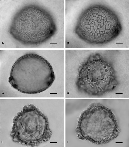 Figure 1 LM ofJaborosa runcinata pollen. A‐C. Slightly tilted equatorial view of pollen with incomplete reticulum. (A) High focus. (B) Low focus. (C) Mid focus showing the thin exine. D‐F. Polar view of pollen with a gemmate‐granular ectexine. (D) High focus. (E) Mid focus. (F) Mid focus showing the aspidate pores. Scale bars – 8 µm.