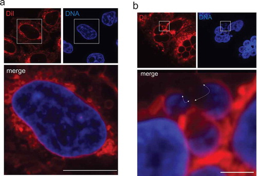 Figure 1. Fluorescence visualization of the nuclear boundary using the lipophilic dye DiI. (a) HeLa cells were incubated with DiI, followed by fixation in paraformaldehyde and DNA staining by Hoechst 33,342. DiI and DNA staining patterns are represented at the upper-left and upper-right, respectively. A merged image is shown at the bottom. Bar: 10 μm. (b) After MN were induced pharmacologically in HeLa cells, DiI staining was performed (upper-left). Nuclear DNA was visualized with Hoechst 33,342 (upper-right). A merged image is shown at the bottom. The area exhibiting discontinuous DiI signals around MN are indicated by white arrows. Bar: 2.5 μm. In A and B, all fluorescence images were taken by an FV1200 laser scanning confocal microscope imaging system.