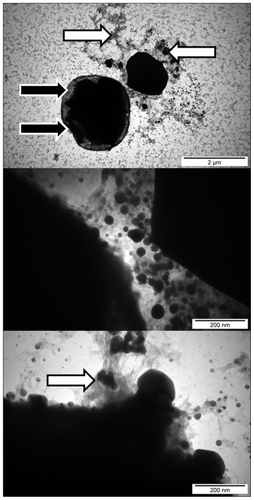 Figure 6 Interaction between Candida albicans and silver nanoparticles. White arrows indicate nanoparticles attached to the substance released by microorganisms. Black arrows indicate distorted cells, a disintegrated cell wall, and cytoplasmac membrane.