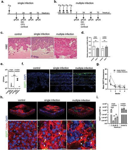 Figure 2.  P. gingivalis infection of the 3D gingival model. The OTG model was used to investigate infection with P. gingivalis. Two models of infection were applied: single (a) and multiple (b) inoculations. The latter is thought to reflect chronic exposure to bacteria. (c) The morphology of the OTG model infected with 33277 was evaluated using H&E staining; scale bar, 100 μm. (d) Infection with 33277 has no influence on Ki67 mRNA expression measured by qPCR. Data represent mean ± SD of at least three replicates; ns, not significant. (e) To detect viable bacteria inside the OTG model, the cultures were lysed at 24 h p.i. and plated for viable counting expressed as CFU/mL. Additionally, the conditioned medium (basolateral side of the insert) was plated for viable counting. Each point represents the number of CFU ± SD of at least two replicates. ***p < 0.001. (f) The localization and penetration of 33277 in gingival tissue was visualized using antibodies against bacteria (P. gingivalis, green; nuclei, blue; scale bar, 100 μm). (g) Green fluorescence was quantified using ImageJ software and is presented as mean ± SD. ****p < 0.0001, **p < 0.01, *p < 0.1. To confirm infection of the OTG model with bacteria, confocal microscopy was performed. (h) 3D confocal visualization was constructed from a z-stack comprising 200 images of the OTG model. Control and single- and multiple-infected cultures were costained with an anti-P. gingivalis antibody (green), phalloidin (actin, red), and DAPI (nuclei, blue) at 24 h p.i..; scale bar, 20 μm. Moreover, single optical slices of the OTG model showed the presence of P. gingivalis in epithelial cells following single and multiple inoculations. Arrows indicate intracellular bacteria. (i) Evaluation of bacterial persistence in the infected OTG model by determination of the bacterial DNA number up to 72 h p.i. Bars represent mean ± SEM. ****p < 0.0001. Similar results were obtained in at least two replicates in two independent experiments.