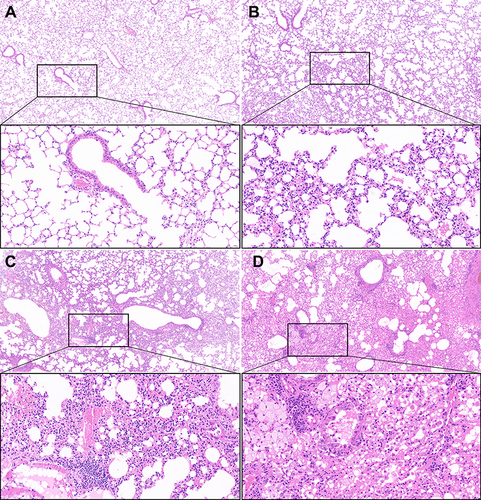 Figure 1 HE staining of lung tissue 1 month after irradiation and/or anti-PD-1 treatment in each group.