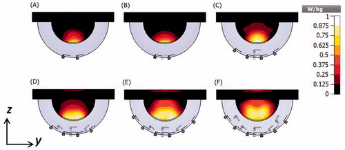 Figure 7. SAR cross-sections on the yz-planes of the small breast model and antenna array configurations of 2 (A), 4 (B), 8 (C), 12 (D), 16 (E) and 20 (F) antennas with constant phase. SAR normalised to the maximum value on the system.