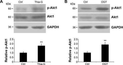 Figure 4 Up-regulation of O-GlcNAcylation increases Akt1 phosphorylation.