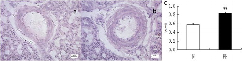 Figure 1. HE staining of broiler lungs (Bar = 20 µm). HE staining of healthy lungs (a), compared with lungs from the PH (b). (c) Bar graph showing the contradistinction of thickness between the healthy group and the PH group (**P < 0.01).