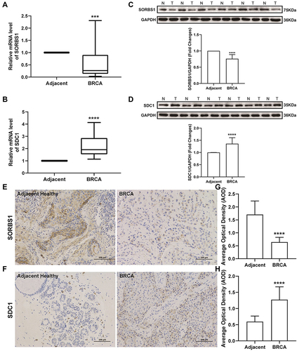 Figure 6 Expression levels of SORBS1 and SDC1 proteins in clinical samples. (A) Expression levels of SORBS1 measured by qRT-PCR analysis. (B) Expression levels of SDC1 measured by qRT-PCR analysis. (C) Representative image of Western blot analysis of SORBS1 protein. N, Adjacent healthy samples; T, BRCA samples. (D) Representative image of Western blot analysis of SDC1 protein. (E) Immunohistochemical staining (SORBS1 protein) of BRCA and adjacent healthy groups; magnification, ×200. (F) Immunohistochemical staining (SDC1 protein) of BRCA and adjacent healthy groups; magnification, ×200. (G and H) The AOD of SORBS1 and SDC1 protein in BRCA and adjacent healthy groups. Mean ± SEM; n = 30; ***P < 0.001 vs adjacent healthy; ****P < 0.0001 vs adjacent healthy.