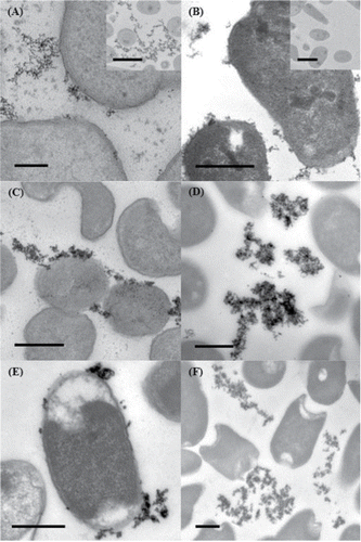 Figure 4. TEM of thin sections of aerobically grown cells showing extracellular palladium; (A) MC4100, inset BL21; (B) BW25113, inset BL21 (no Pd); (C) FTD128; (D) JW2682; (E) MC4100 ΔmoaA; (F) JW3865. Scale bar (A) = 100 nm; (B)-(F) = 500 nm; insets = 1 μm.