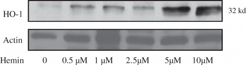 Figure 1.  Equal numbers of mesangial cells were incubated in media containing variable concentrations of hemin (0, 0.5, 1.0, 2.5, 5.0, and 10.0 μM) for 16 hours followed by preparation of Western blots and probing for HO-1 expression. The upper panel shows dose response effect of hemin on mesangial cell expression of HO-1. The lower panel shows actin content of MCs under the same conditions.