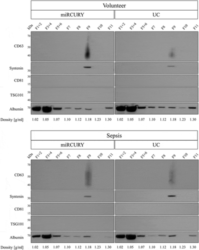 Figure 9. Analysis of EV markers and human serum albumin in EVs isolated by precipitation and sedimentation and further purified by iodixanol density gradient centrifugation. CD63 and syntenin were detected in a density fraction of 1.18 g/ml, while the majority of albumin floated in fractions of 1.02–1.05 g/ml. Results are representative for two separate biological replicates for both volunteers (top panel) and patients (bottom panel).