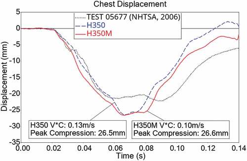Figure 12. Chest displacement time history.