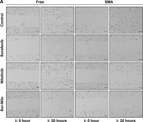 Figure 9 Antimetastic potential of a combination of free and micellar sorafenib and nilotinib.Notes: Effect of sorafenib, nilotinib, SMA-Sor, SMA-Nilo, and their combination treatment on the inhibition of cell migration (A), invasion (B), and angiogenesis (C). PC3 cells monolayer was scratched, treated with free or micellar sorafenib 2.5 μM and/or nilotinib 3 μM, and incubated for 20 hours. Representative pictures were taken at 0 hour and 20 hours (A). For cell invasion, PC3 cells were treated as indicated previously. After 20 hours, the cells migrating to the lower chamber were fixed and stained with Diff Quick. Representative pictures were taken and number of cell per field were counted. Bars represent the mean ± SEM of three independent experiments (B). Conditioned mediums were collected from cell cultures following 48 hours incubation as indicated previoulsy and analyzed by gelatin zymography for MMP-9 activity and Western blot for the expression of MMP-9 and ISM-1 (C). Experiments were done in triplicate (n=3). *P<0.05 compared to control, and **P<0.05 comparing of free drug versus combination treatments. Scale bar denotes 100 μm.Abbreviations: SMA, poly(styrene-co-maleic) acid; SEM, standard error of the mean; MMP, matrix metalloproteinase; ISM-1, isthmin-1; t, time.